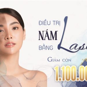 dieu-tri-nam-laser